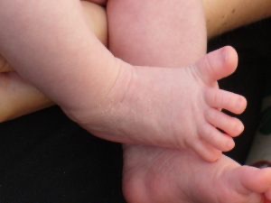 An infant's foot with toes fanning out