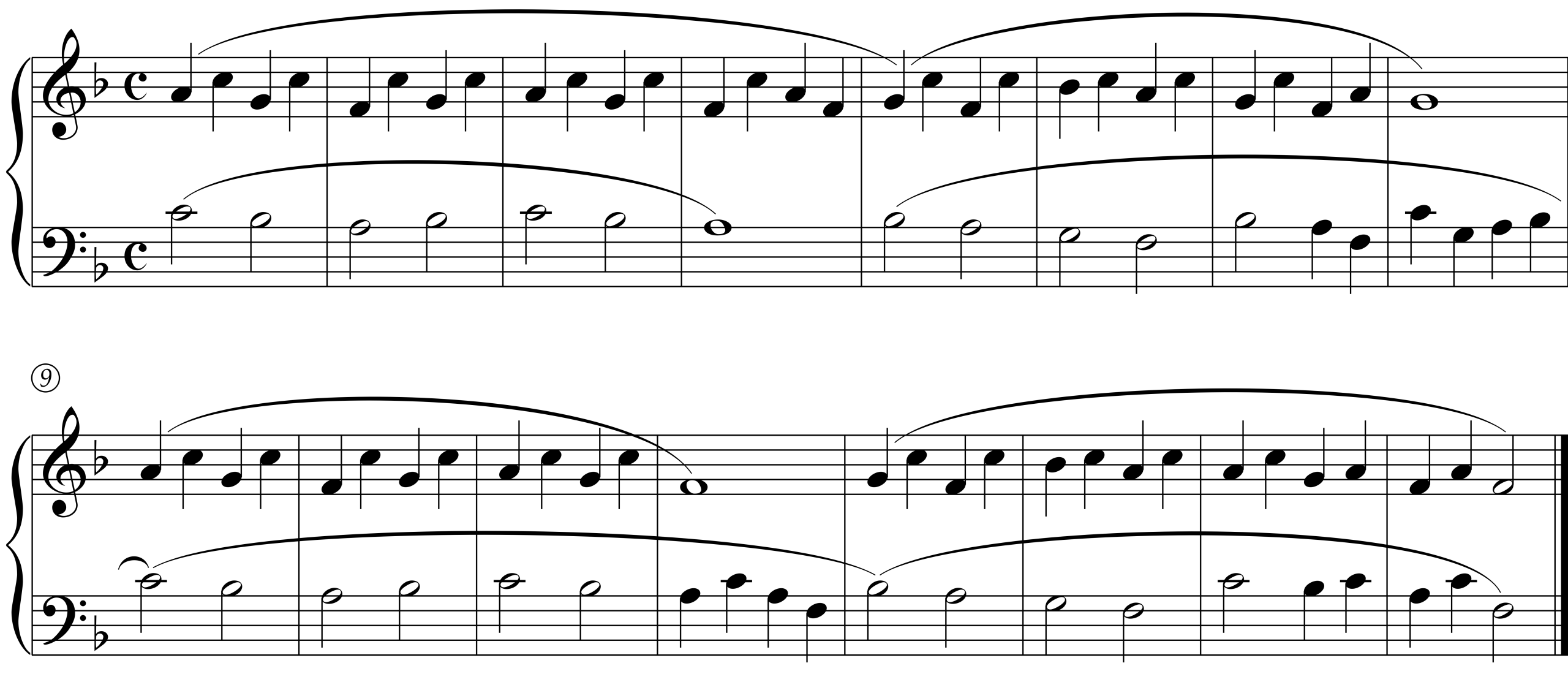 Ferdinand Beyer: Etude Op. 101, No. 28