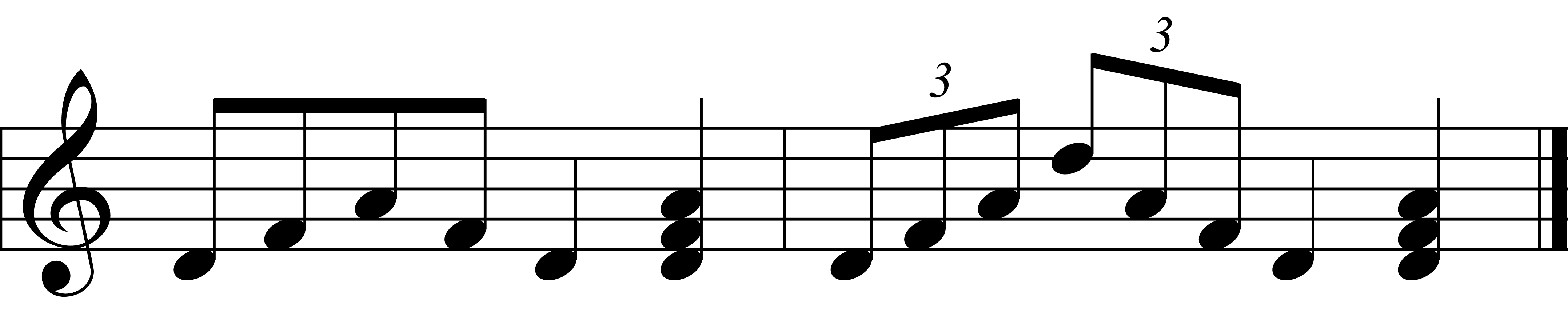 D Minor RH