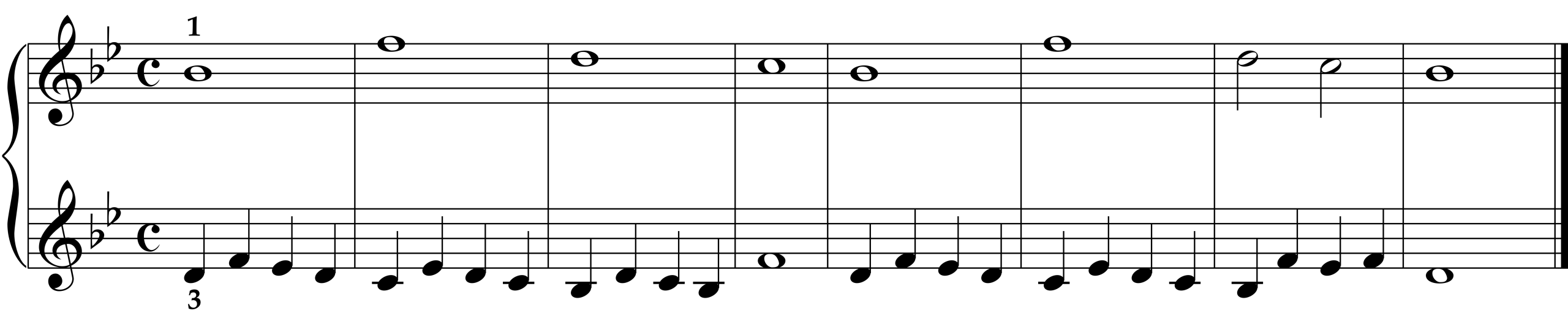 Cornelius Gurlitt: Etude Op. 82, No. 11