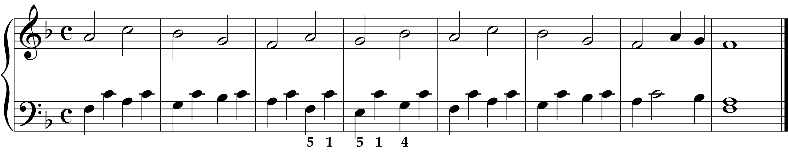 Cornelius Gurlitt: Etude Op. 82, No. 13