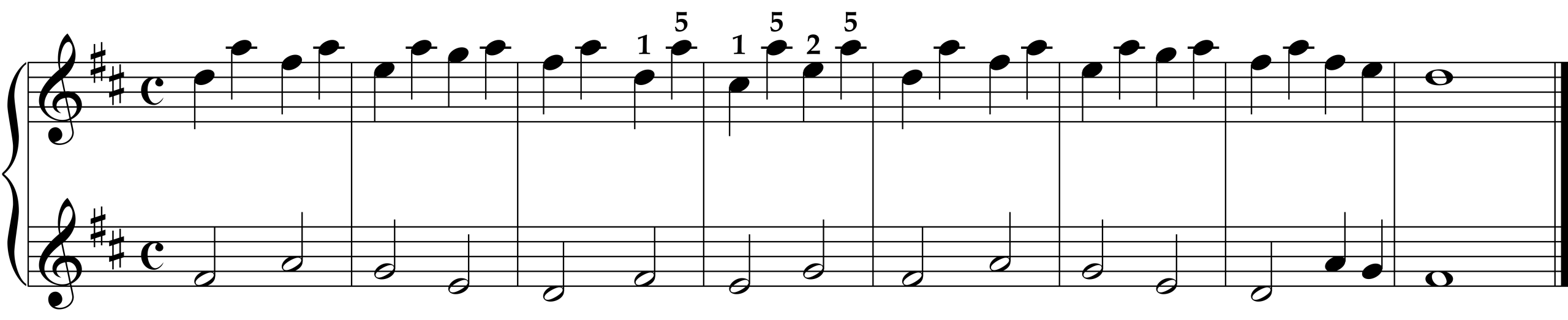 Cornelius Gurlitt: Etude Op. 82, No. 14