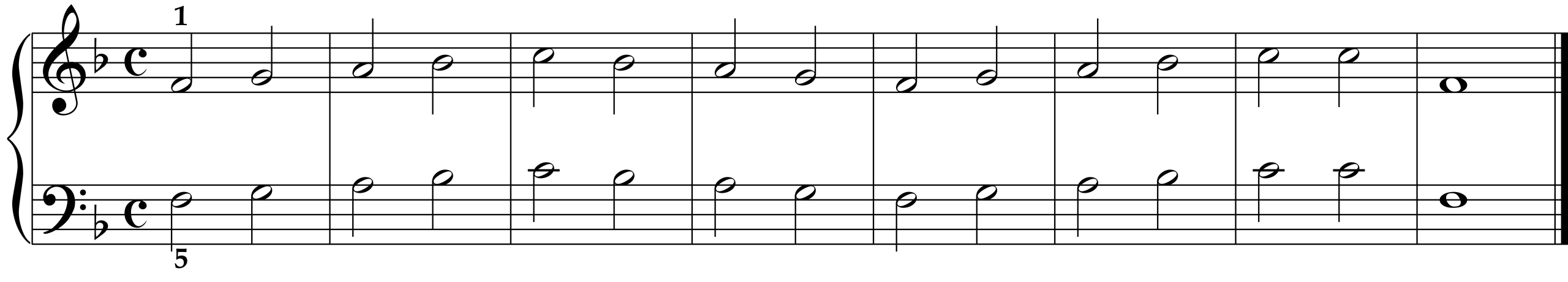 Cornelius Gurlitt: Etude Op. 82, No. 1