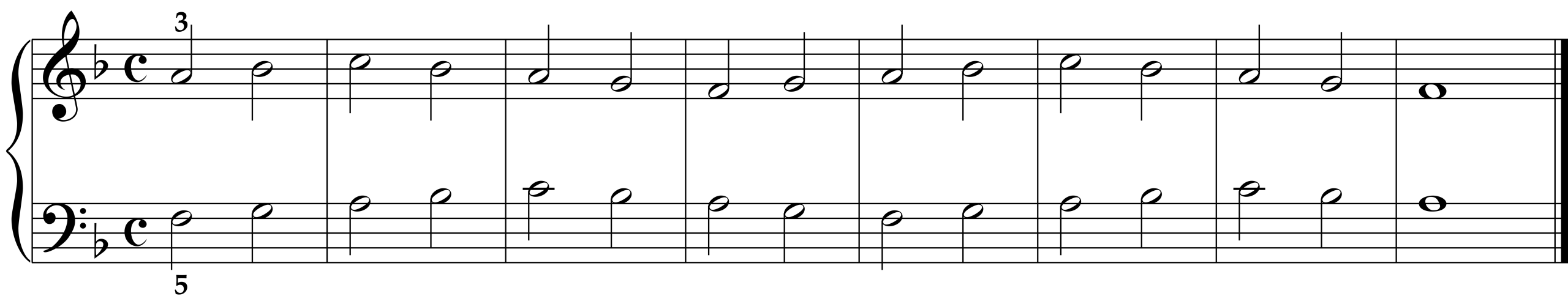 Cornelius Gurlitt: Etude Op. 82, No. 8