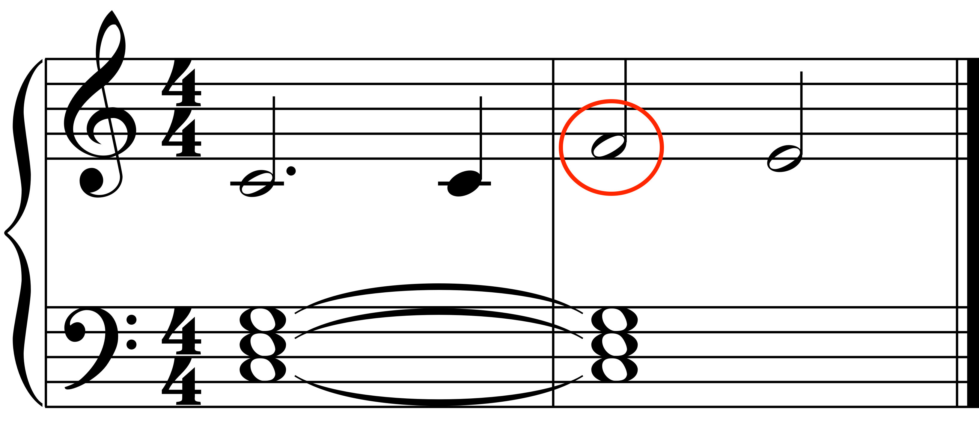 Appoggiatura example