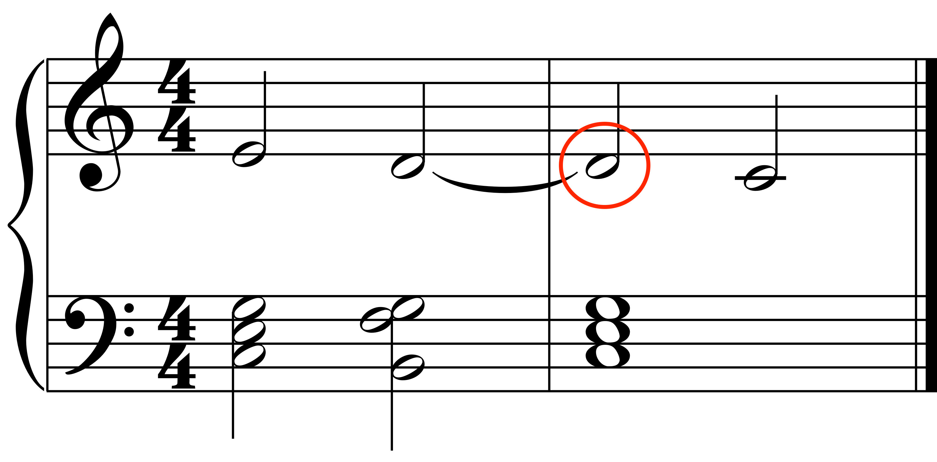 Suspension example